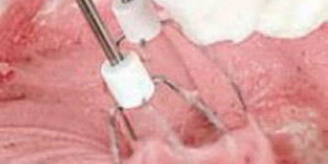 Рецепт мусса клюквенного из манной крупы