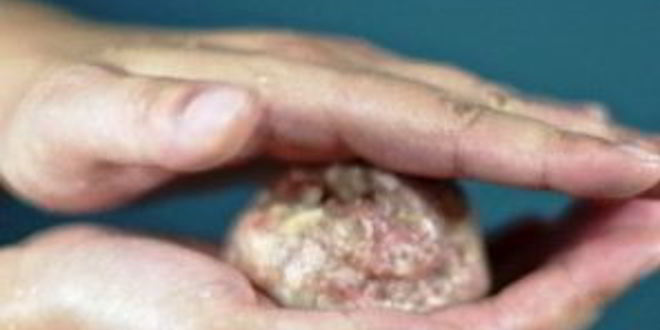 Рецепт котлет, фаршированных грибами