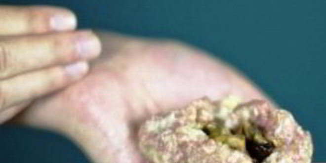 Рецепт котлет, фаршированных грибами