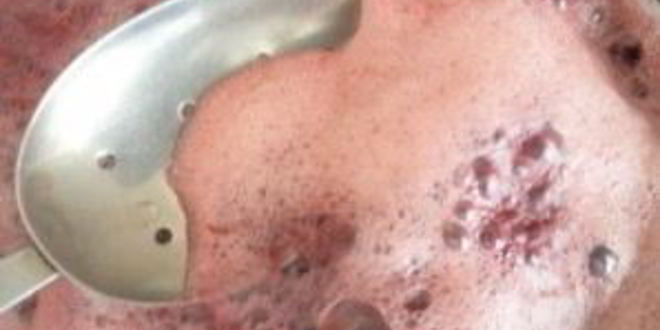 Рецепт киселя из смородинового варенья