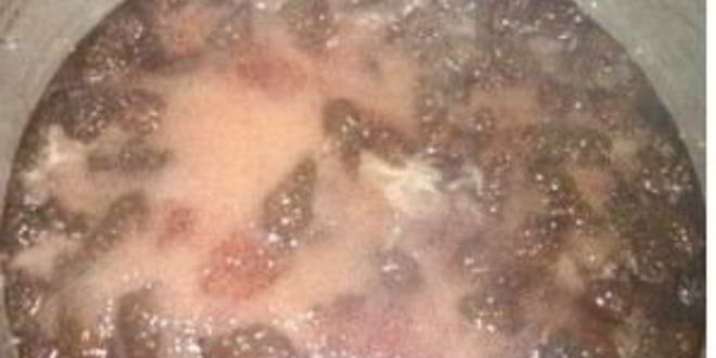 Рецепт сиропа из сосновых шишек