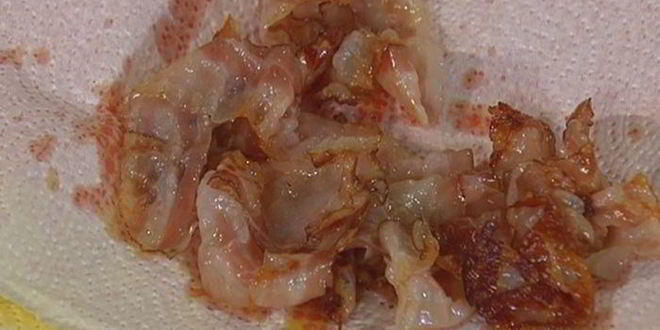 Рецепт салата с картофелем, беконом, фасолью и яйцами пашот