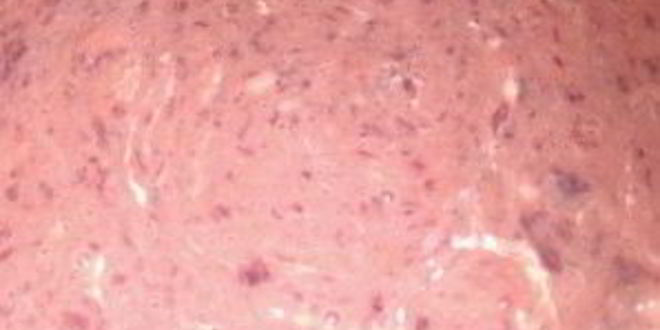 Рецепт печеночных оладий на сметане